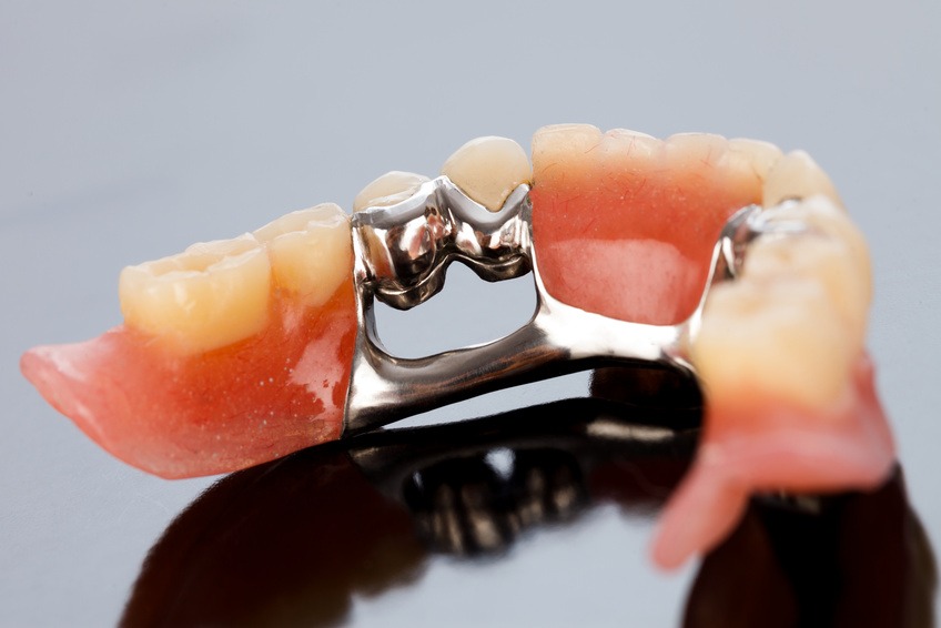 The inner view of a dental skeletal prosthesis with special fixing element.